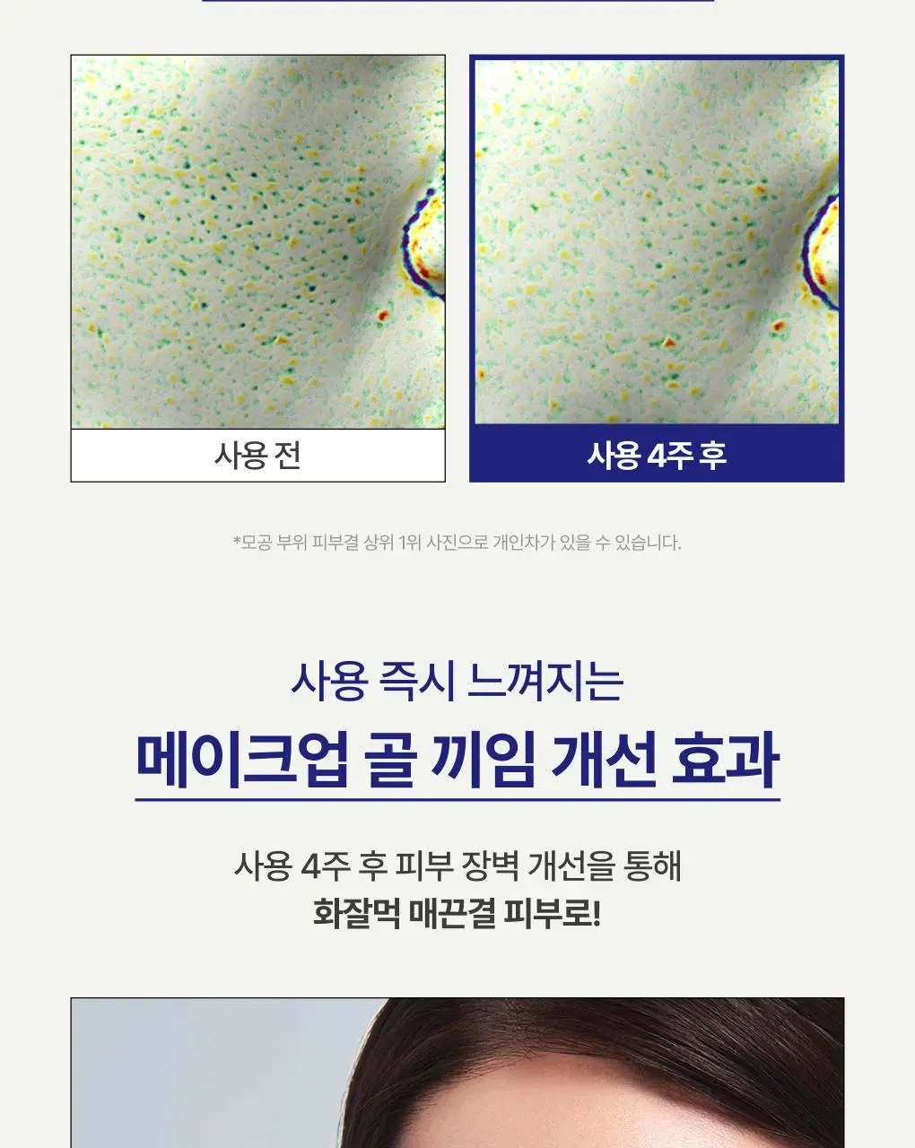 [1+1] 이니스프리 레티놀 시카 모공 흔적 앰플 30ml 리필기획(+30ml 리필) 상세페이지 30